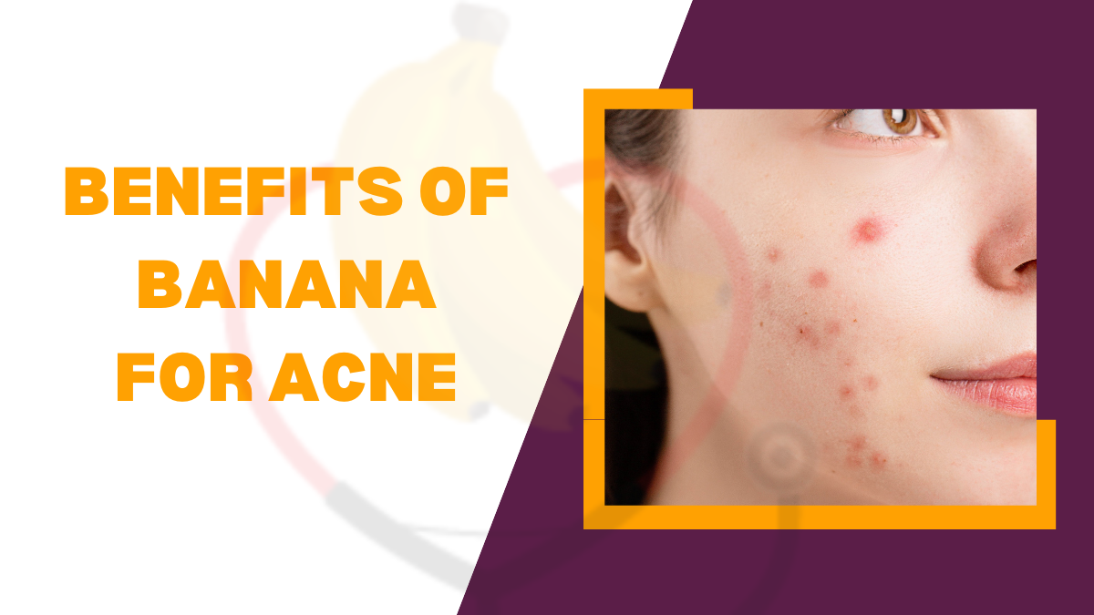 Image showing the benefits of banana for acne