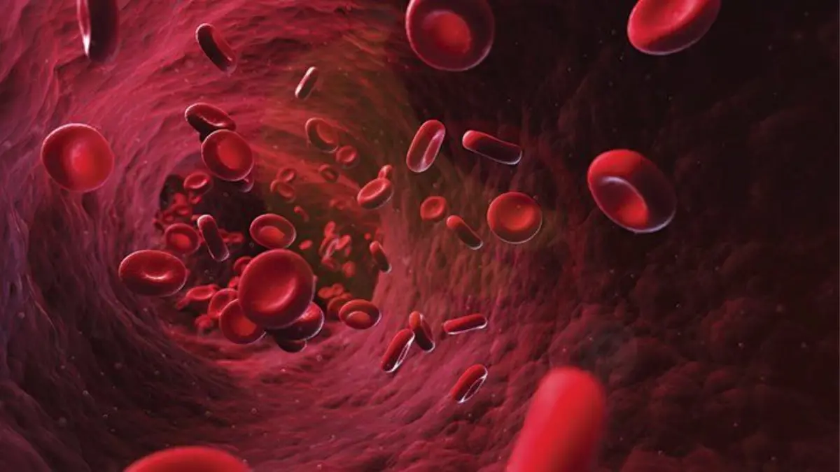 Image showing the Deficiency of Red blood cell